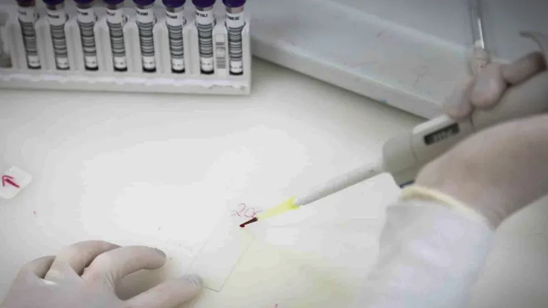 Secretaria de Saúde de SP investiga novo caso suspeito de ebola