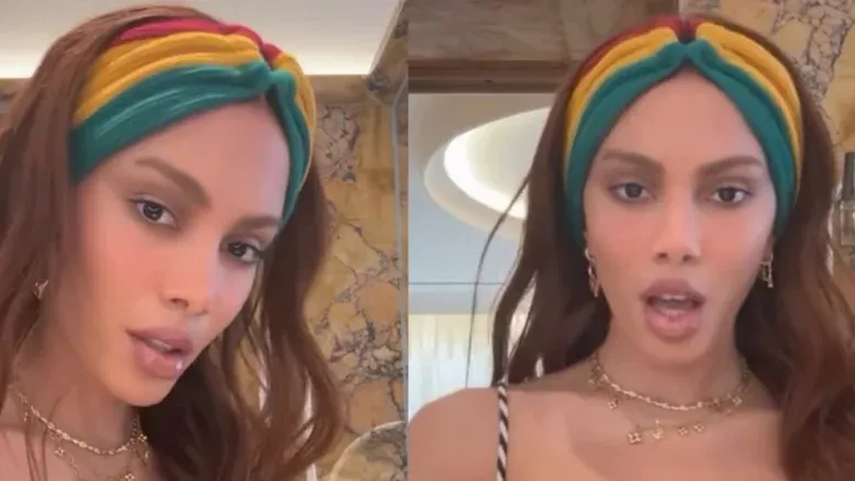 Saiba o valor do possível procedimento estético que mudou o rosto de Anitta
