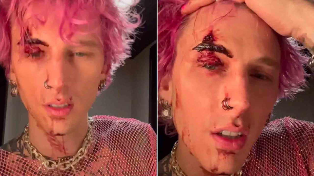 Machine Gun Kelly mostra corte após quebrar taça
