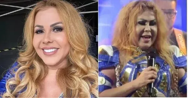 Resultado! Joelma recebe diagnóstico médico após exames
