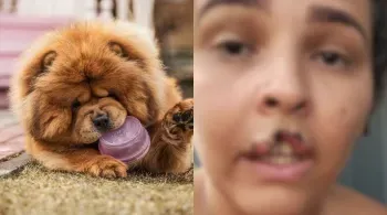 Cachorro arranca pedaço da boca de tutora e é submetido à eutanásia em RO
