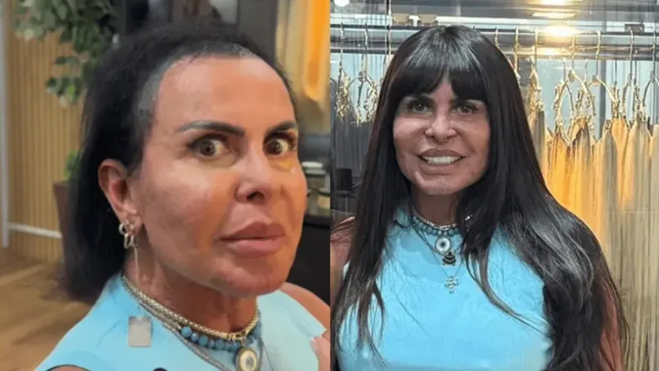Gretchen mostra calvície e põe novo cabelo para o Power Couple